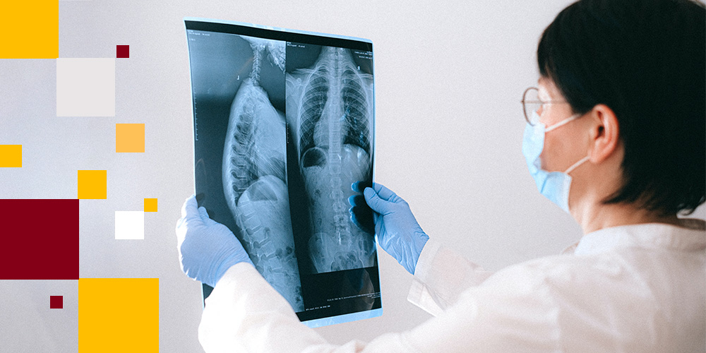 Provider holding up an x-ray of a chest